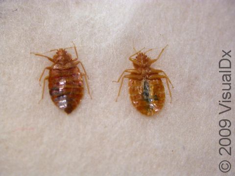 Bedbugs from a top and bottom view.