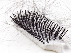 12 Days of Dermatology – Day Nine: Hair Loss