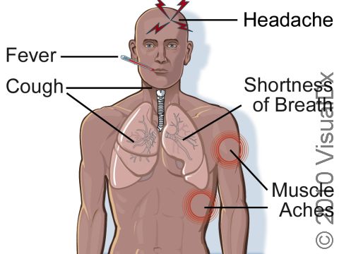 Inhalational anthrax causes severe shortness of breath (dyspnea), cough, fever, muscle aches (myalgias), and headache.