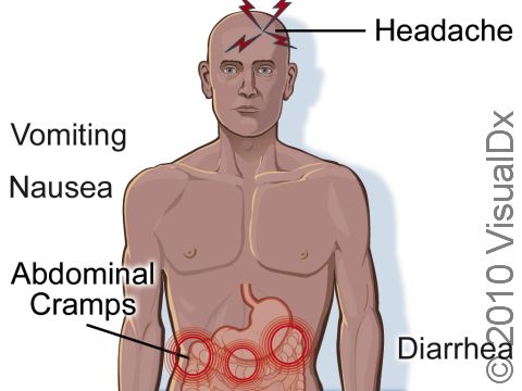 The symptoms of cholera include nausea, vomiting, severe diarrhea, and abdominal cramps leading to profound dehydration.