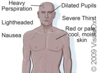 Heat Exhaustion, First Aid – First Aid