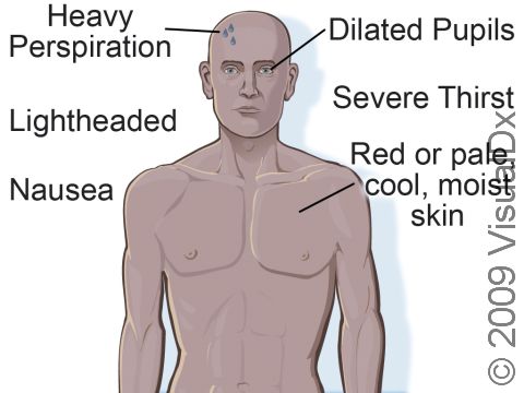 Heat exhaustion signs and symptoms can include heavy perspiration; nausea; lightheadedness; severe thirst; dilated pupils; and red or pale, cool skin.