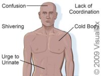 Hypothermia, First Aid – First Aid