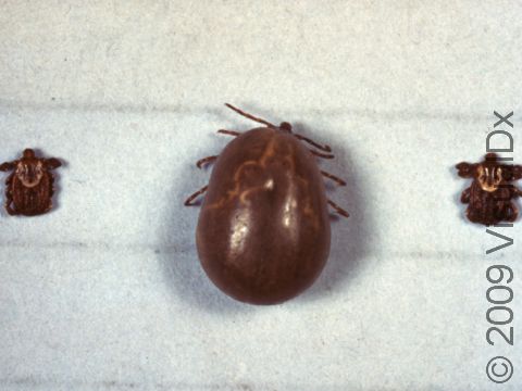 A tick, when filled with blood, can grow quite a bit in size.