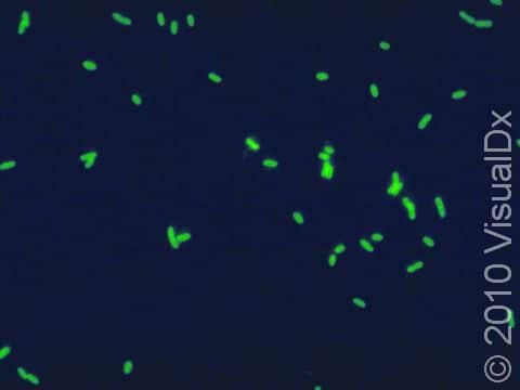 The Legionella pneumophila bacteria are tagged with a monoclonal antibody treated with a fluorescein dye. After binding to the bacteria the slide is viewed under ultraviolet light, and the bacterial cell walls glow green.