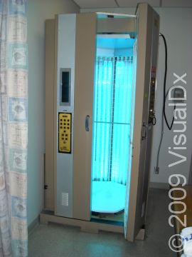 Phototherapy unit that is in use.